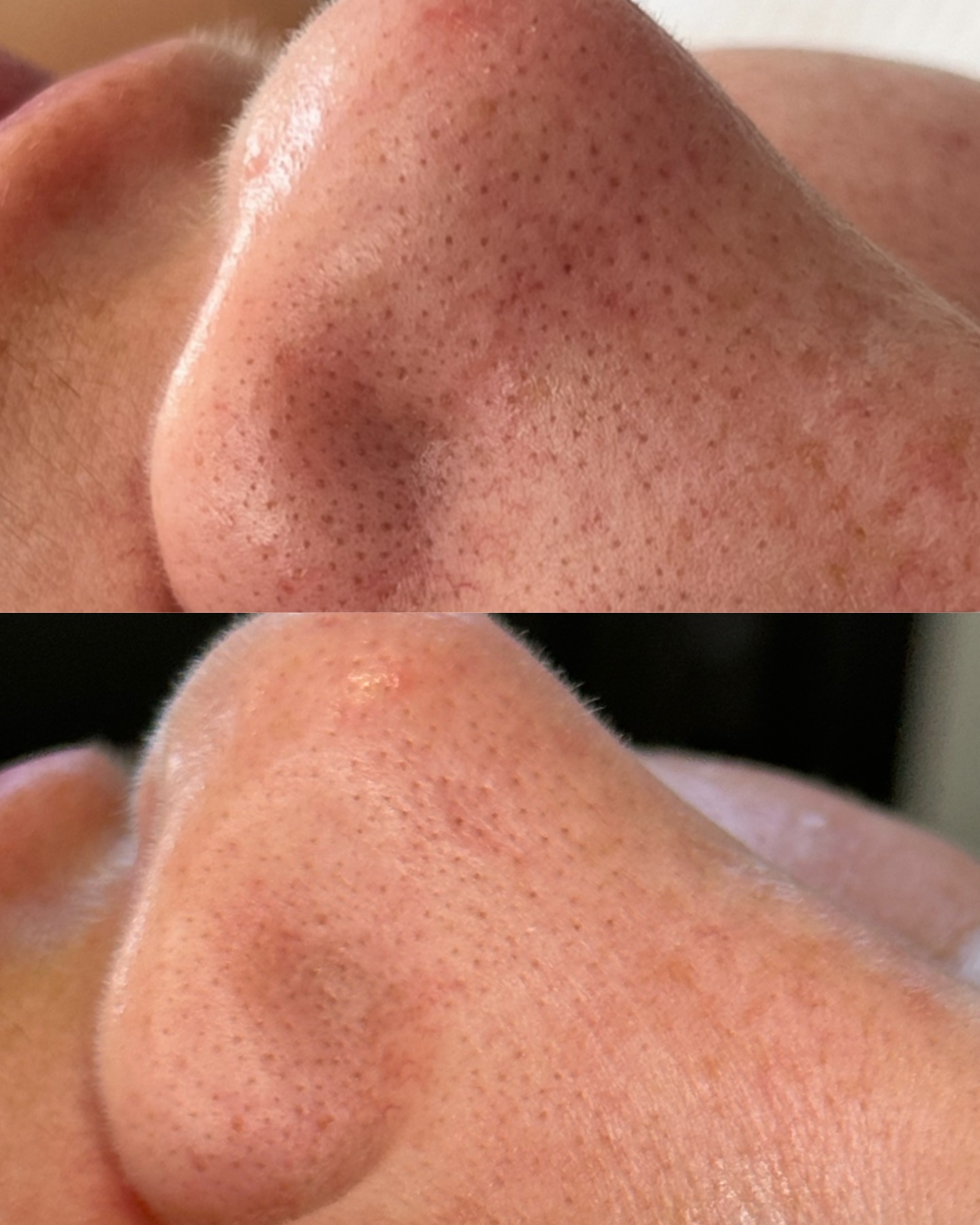 Pores + texture — before and after