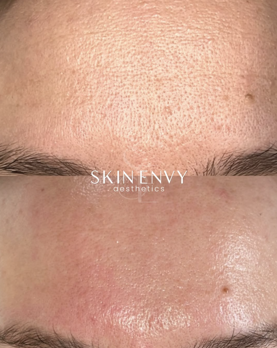 Texture + pores